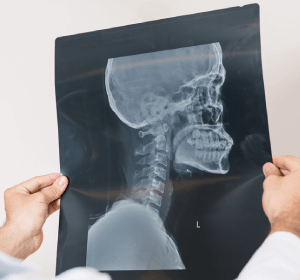 客製化製作骨水泥-新竹骨水泥推薦