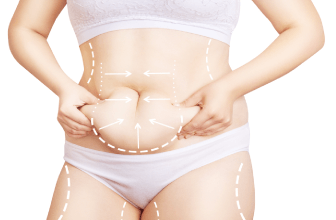 大範圍抽脂、臉部雕塑、狐臭、男性女乳症都能適應 多元適應症-新竹抽脂推薦