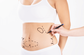 LSSA音浪抽脂採用超音波頻率共振,可均勻融脂,減少術後凹凸不平的情形 在意凹凸不平副作用-新竹竹北抽脂推薦