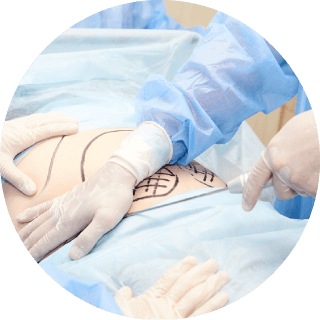 手術安全有效-新竹隆乳推薦