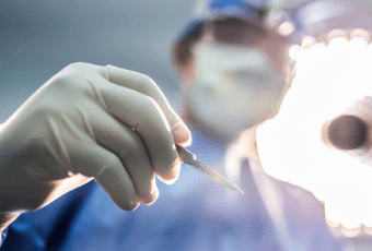 客製化設計-新竹削骨手術推薦