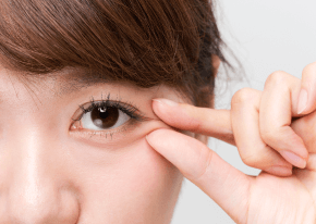 脂肪靈活運用-新竹眼袋推薦