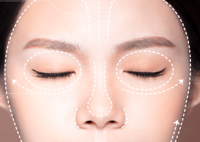 複合式年輕化-新竹眼袋推薦