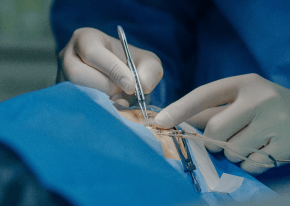 安全把關-新竹眼袋推薦