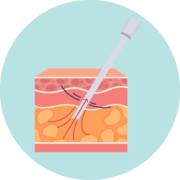 眼袋位移-新竹眼袋推薦