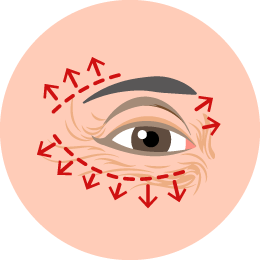 多合一眼袋手術-新竹眼袋推薦