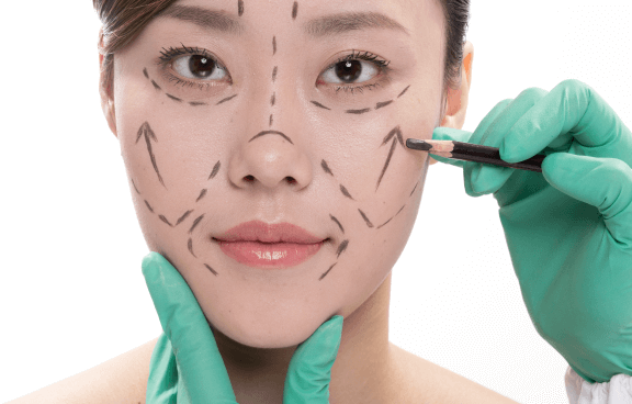 中臉拉皮手術原理-新竹臉部拉皮手術推薦