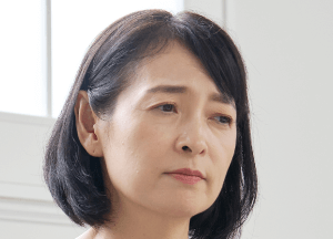 眉型塌陷-臉部拉皮推薦