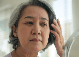 嘴角下垂-新竹臉部拉皮推薦