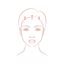 前額拉皮-新竹臉部拉皮手術