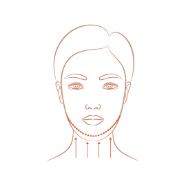 下臉拉皮-新竹臉部拉皮手術推薦