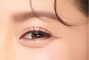 告別泡泡眼-新竹割雙眼皮推薦