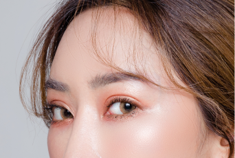 創部最小化-新竹割雙眼皮推薦