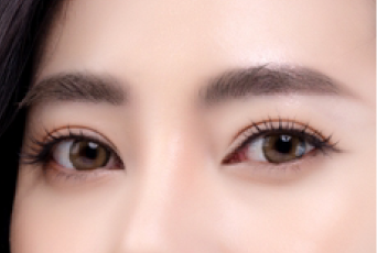 多樣化線條皆可打造-新竹割雙眼皮推薦