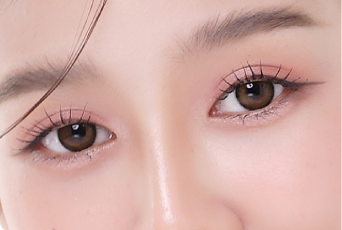 想永久維持雙眼皮狀態者-新竹割雙眼皮推薦