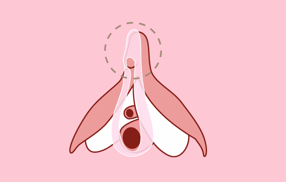 陰蒂包皮修整術-新竹私密處整形手術