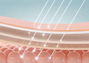 新竹中臉拉提-新竹中臉拉皮推薦