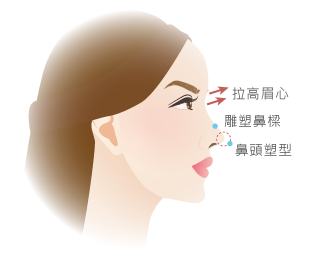 3段式隆鼻-新竹隆鼻推薦