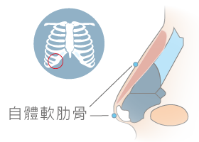 全自體隆鼻-新竹鼻雕推薦