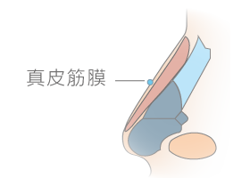 真皮筋膜隆鼻-新竹隆鼻推薦