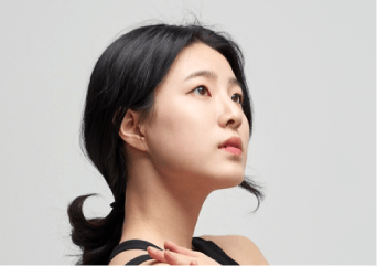 修飾臉型-新竹正顎手術