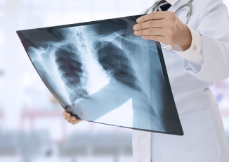 心電圖與X光檢查-PERLE珍珠波隆乳-新竹隆乳推薦