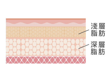 深淺層脂肪影響不同線條體態 深淺層脂肪-新竹抽脂推薦
