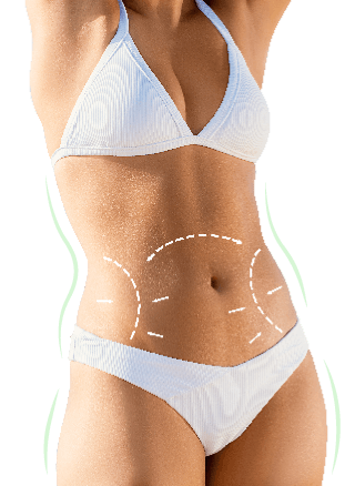 抽脂對象-新竹竹北抽脂推薦