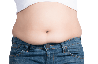 腹部脂肪讓穿衣緊勒不適,讓PAL飆塑抽脂化解肚皮難題! 消除腹部脂肪-新竹抽脂推薦