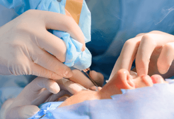 最終調整-新竹縫雙眼皮推薦