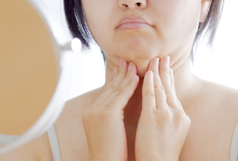 下巴與脖子連結過於緊密-新竹天鵝頸手術