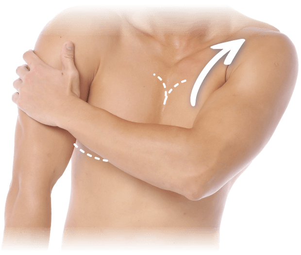 新竹平胸手術-新竹縮胸手術