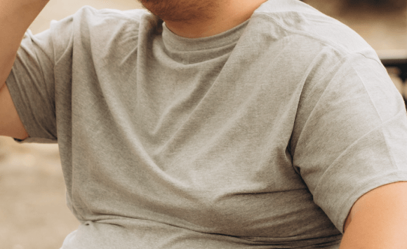 男性女乳症改善-新竹縮胸手術-新竹平胸手術