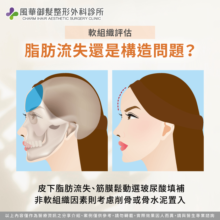 適度削骨或搭配骨水泥-眉毛上方凹陷