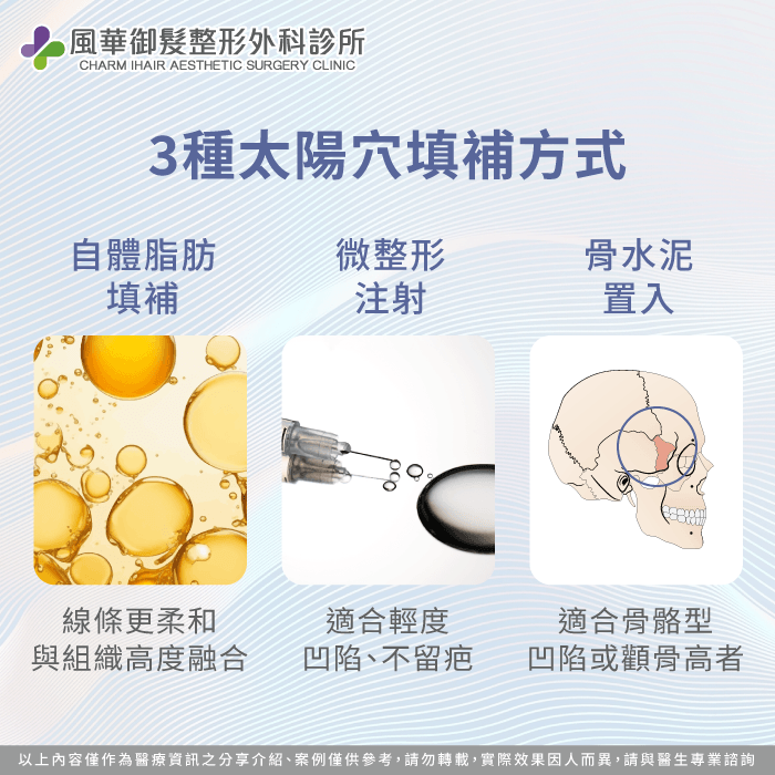 太陽穴凹陷整形改善方式-太陽穴凹陷整形