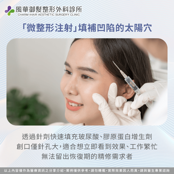 微整形注射方案-太陽穴凹陷
