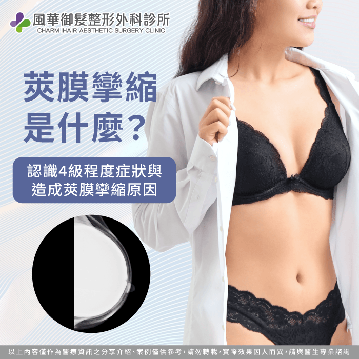 透過專業醫師評估隆乳材質與精密手術能大幅降低術後莢膜攣縮發生率 莢膜攣縮分級與造成原因解析-莢膜攣縮是什麼