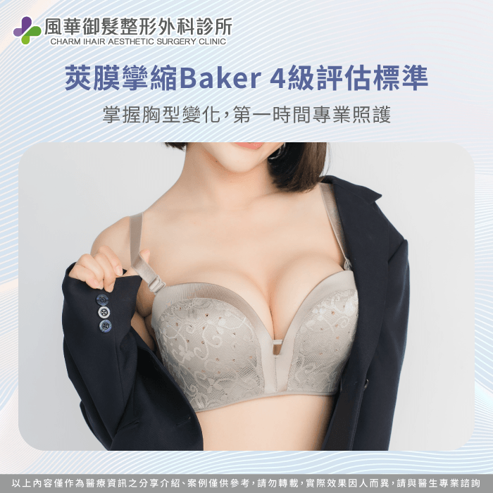 臨床上採用Baker分級法區分胸部觸感與視覺變形的程度 莢膜攣縮4級判斷指標-莢膜攣縮是什麼