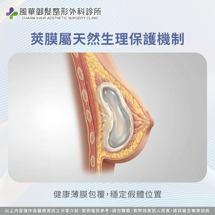 健康的薄莢膜能固定假體位置並維持天然胸部的柔軟質感 人體自然形成防護莢膜機制-莢膜攣縮是什麼