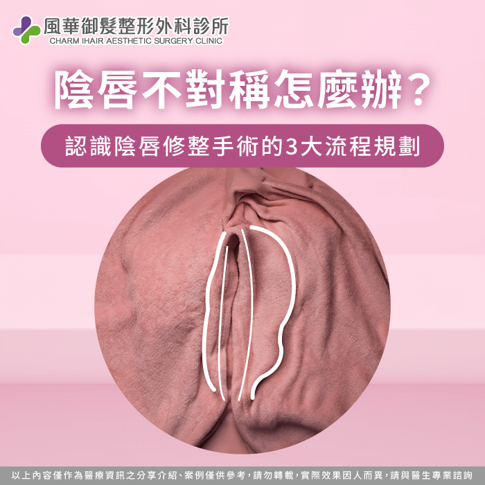 陰唇不對稱-陰唇修整