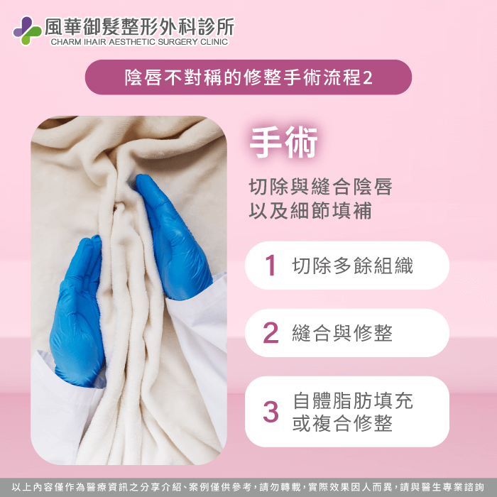 手術階段-陰唇修整