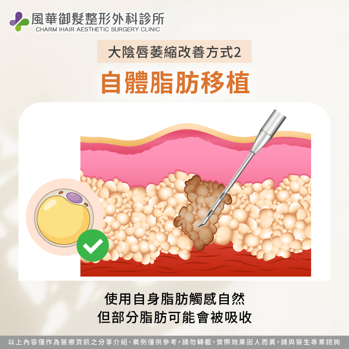 自體脂肪填充-大陰唇萎縮怎麼辦