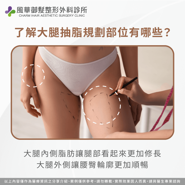抽脂規劃部位-大腿抽脂 規劃