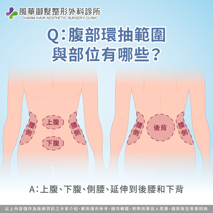 腹部環抽範圍與部位有哪些-腹部環抽範圍