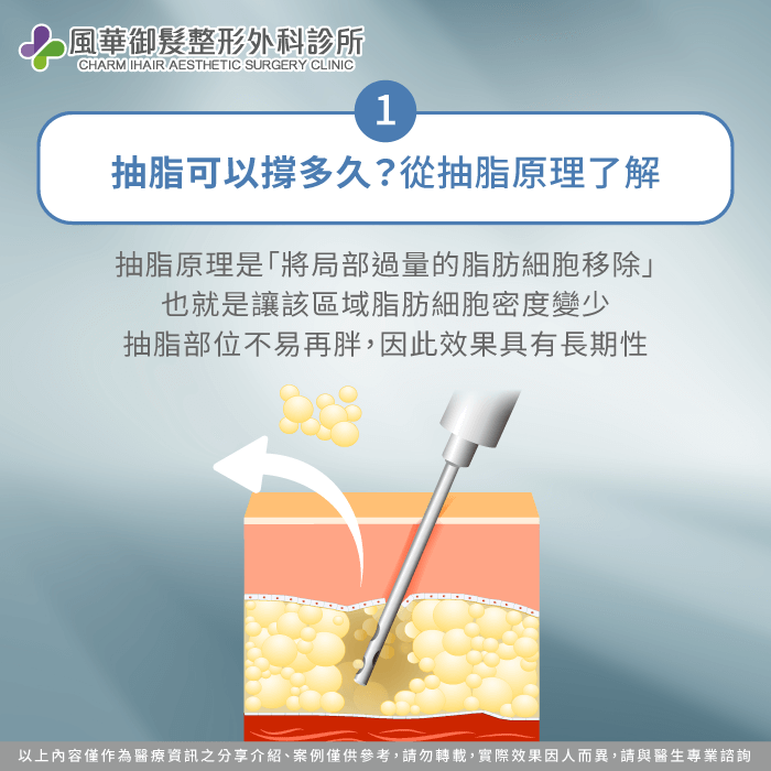 抽脂可以撐多久-新竹抽脂推薦