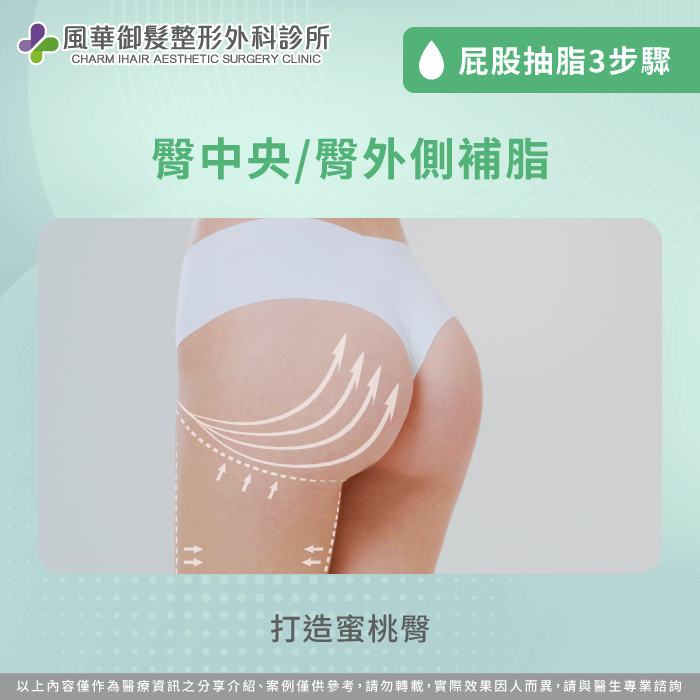 臀部中間/外側補脂-屁股可以抽脂嗎