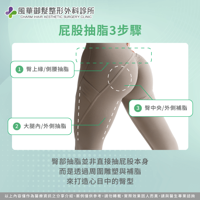 屁股可以抽脂嗎-屁股大 抽脂