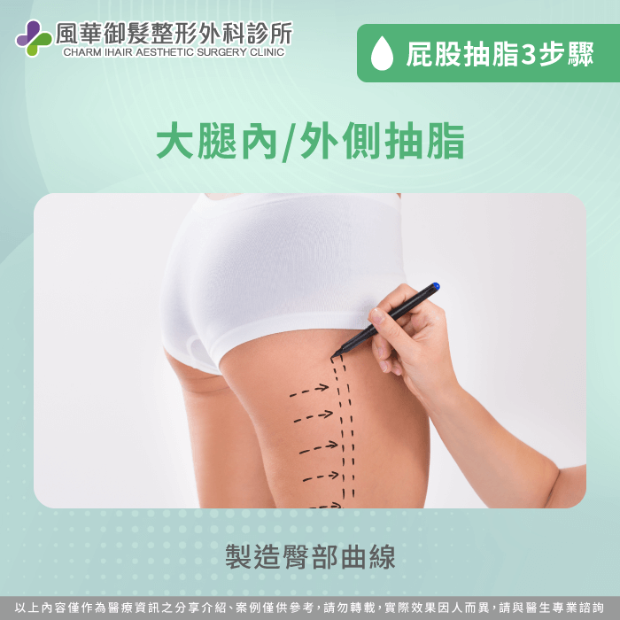 大腿內側/外側抽脂-屁股可以抽脂嗎