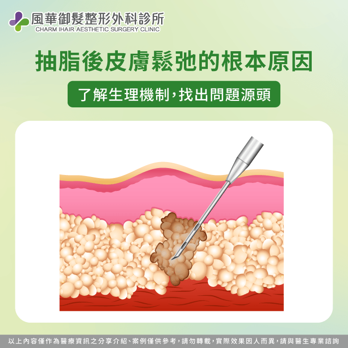 深入了解生理機制從根本改善抽脂後皮膚鬆弛情形 了解生理機制改善鬆弛-抽脂後皮膚鬆弛