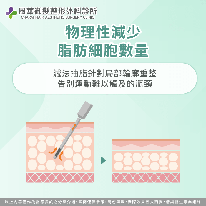 減重與抽脂生理結構差異-抽脂體重會變嗎